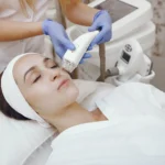 Fractional CO2 Laser Skin Treatment
