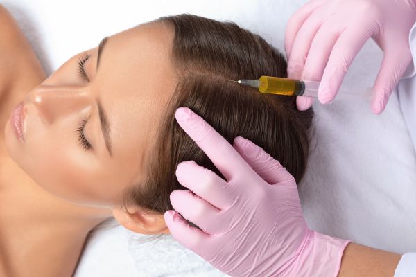 PRP-Hair-Restoration-treatment