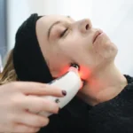 melasma treatment 2025